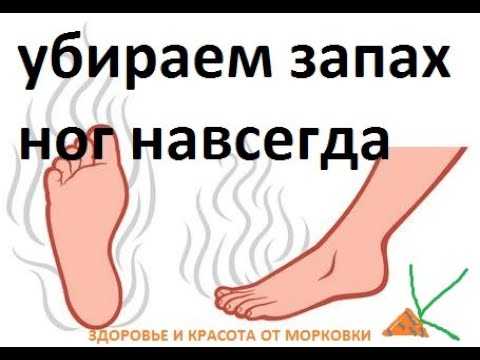 Запах ног у мужчин причины