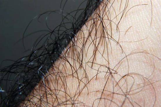Седеют волосы на лобковой части чего не хватает в организме