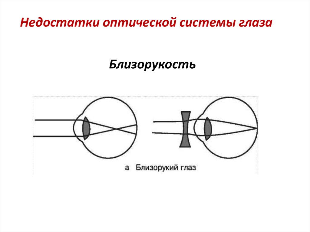 Дальнозоркий астигматизм