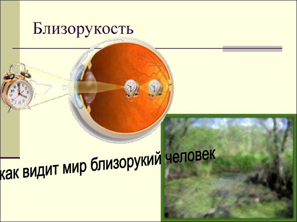 Видим 2. Близорукость как видит человек. Близорукость 1.5. Как видит человек с близорукостью -1. Миопия как видит человек.