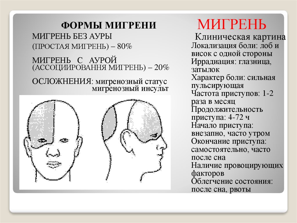 Виды головной боли в картинках и их причины