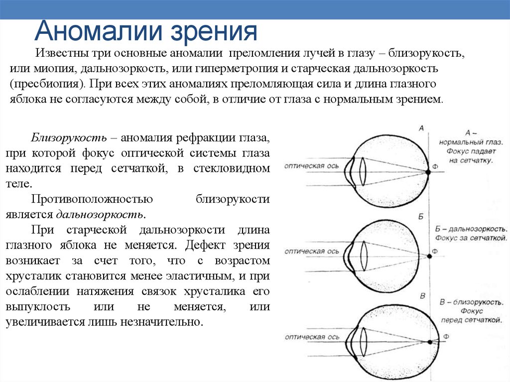 Схема преломления лучей хрусталиком глаза