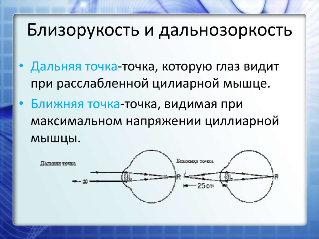 Дополните предложения изображение в близоруком глазу фокусируется сетчатки