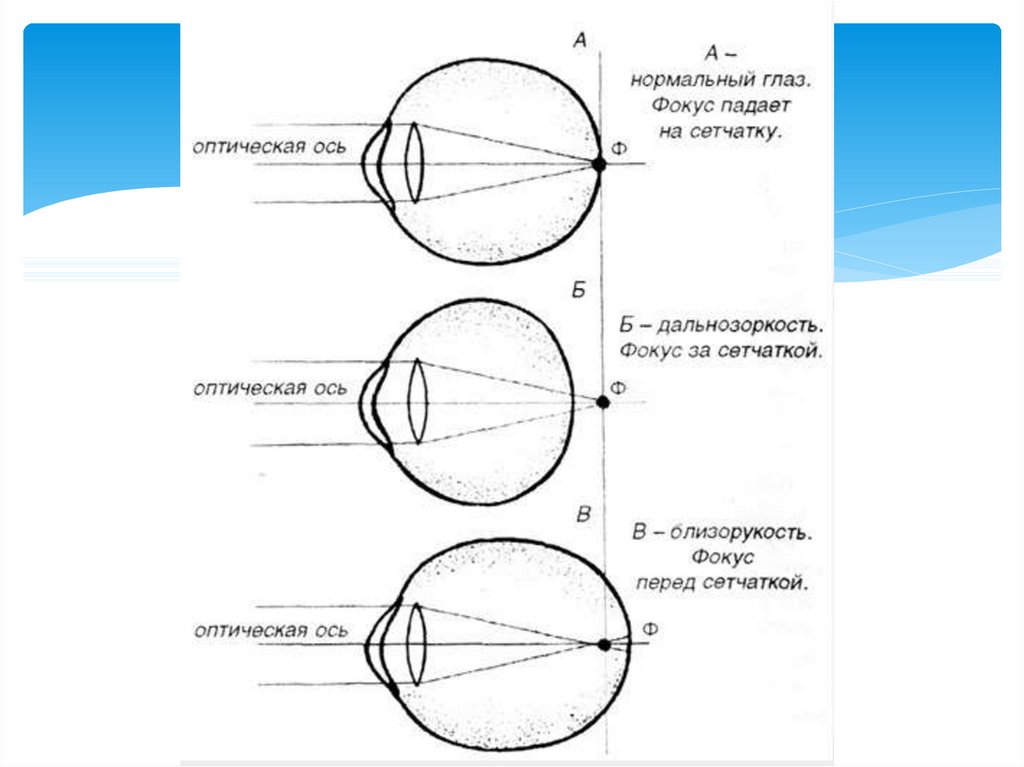 Нормальные точки. Зрительная и оптическая ось глаза. Оптическая ось и Зрительная ось. Зрительная ось глазного яблока. Оптическая ось глаза.