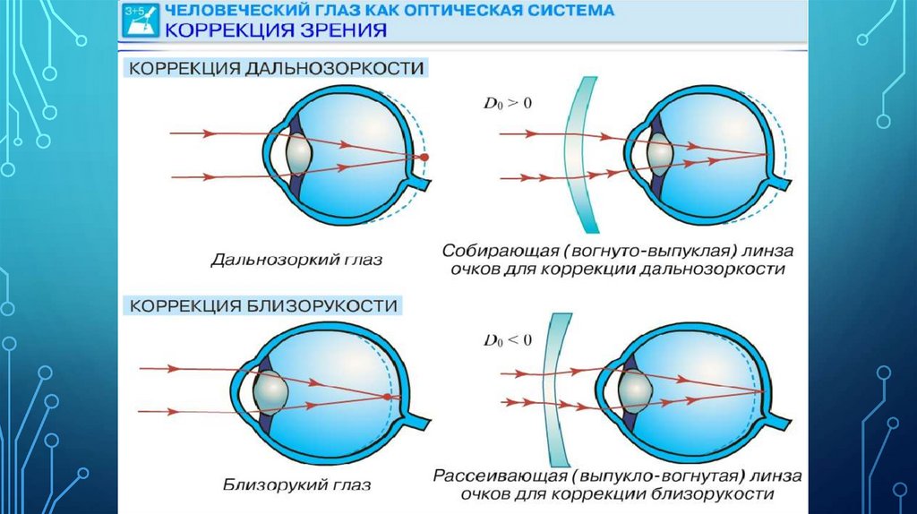 Нарушение зрения схема