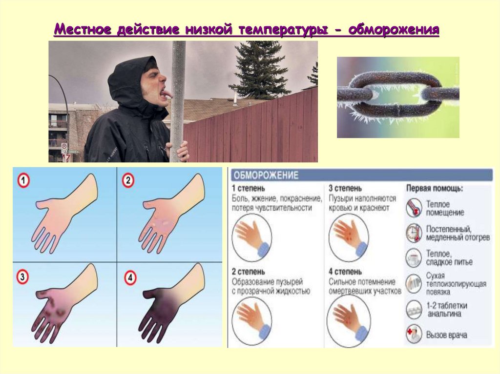 Обморожение первая помощь