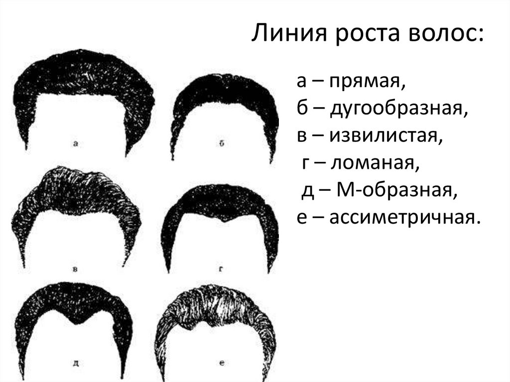 Рост волос у мужчин по женскому типу у мужчин