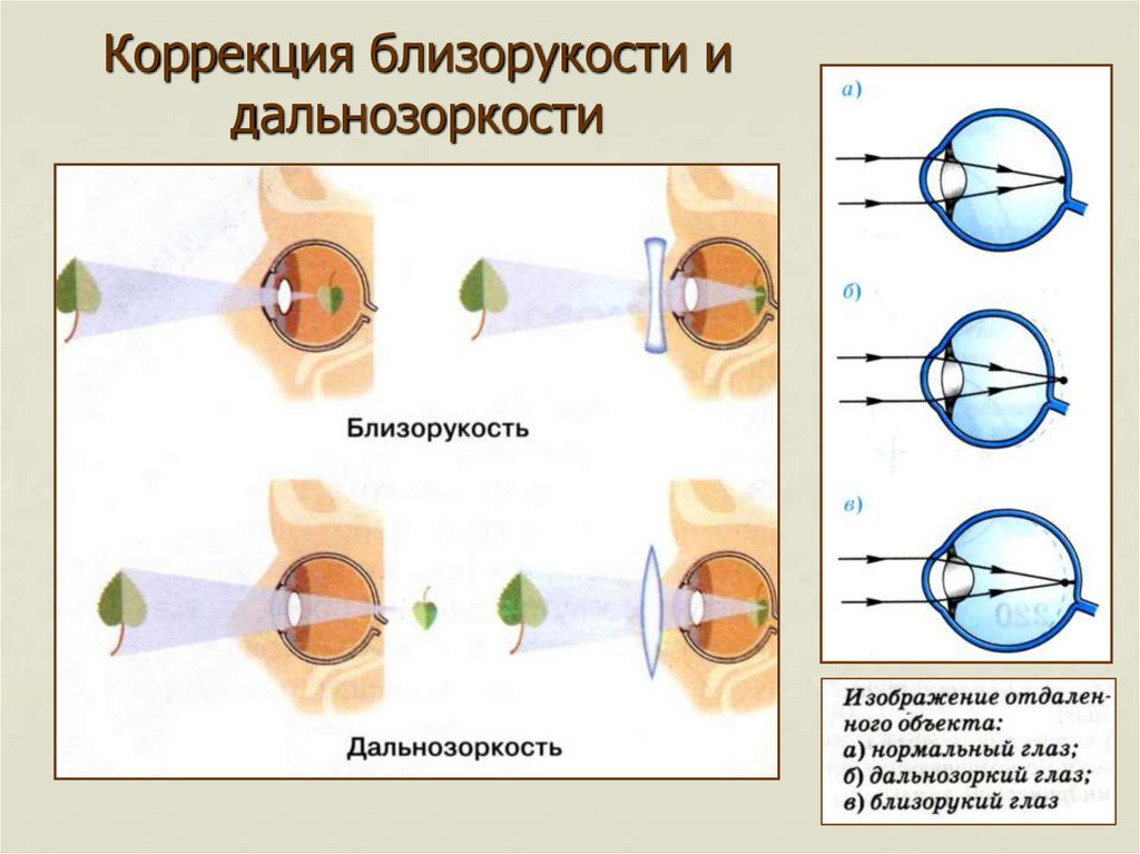 Близорукость рисунок физика