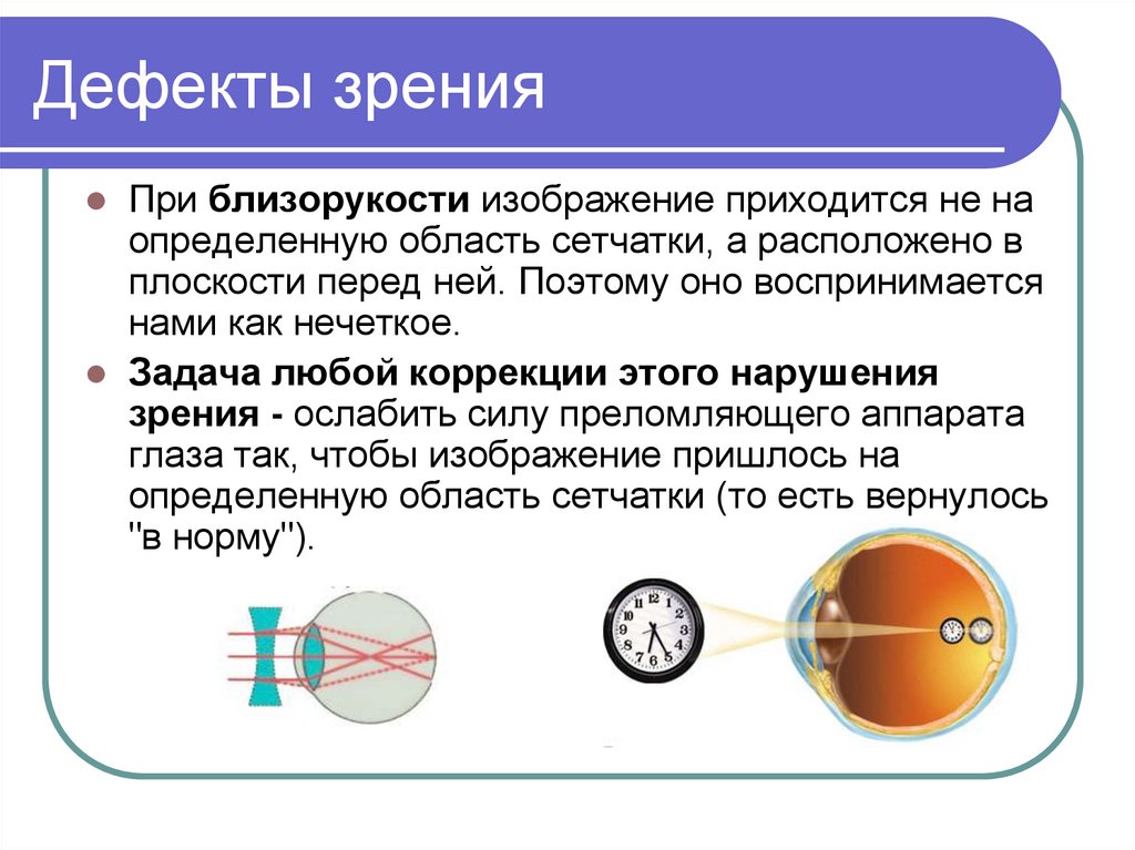 Презентация на тему глаз как оптическая система физика