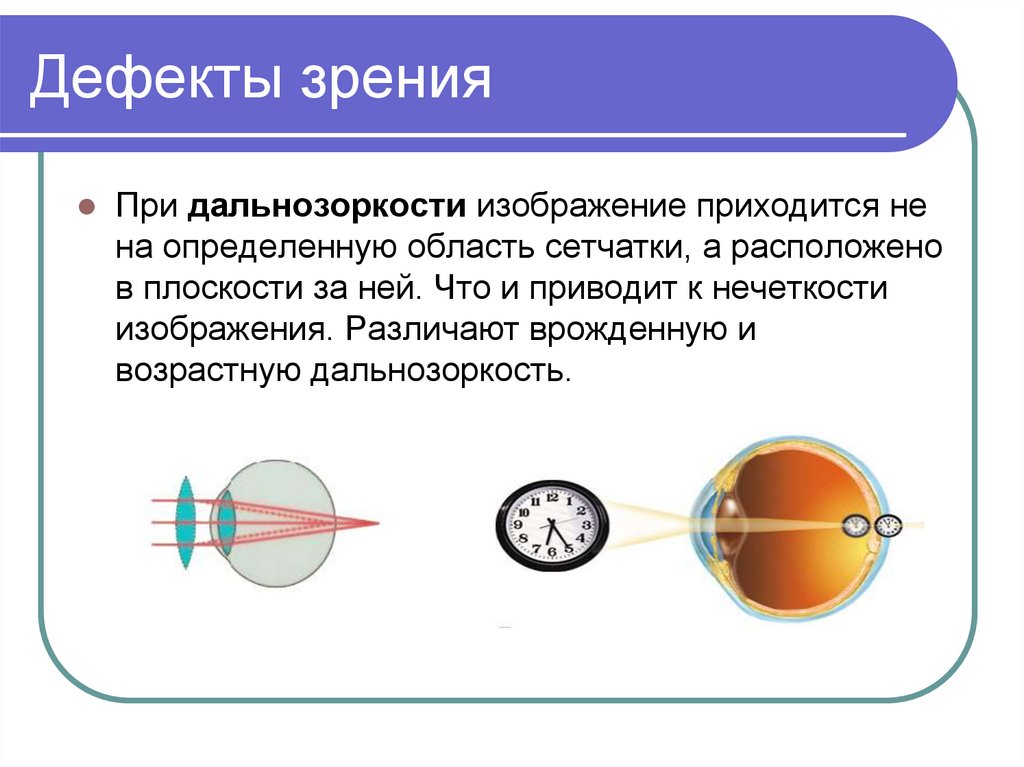 Глаз характеристика изображения физика