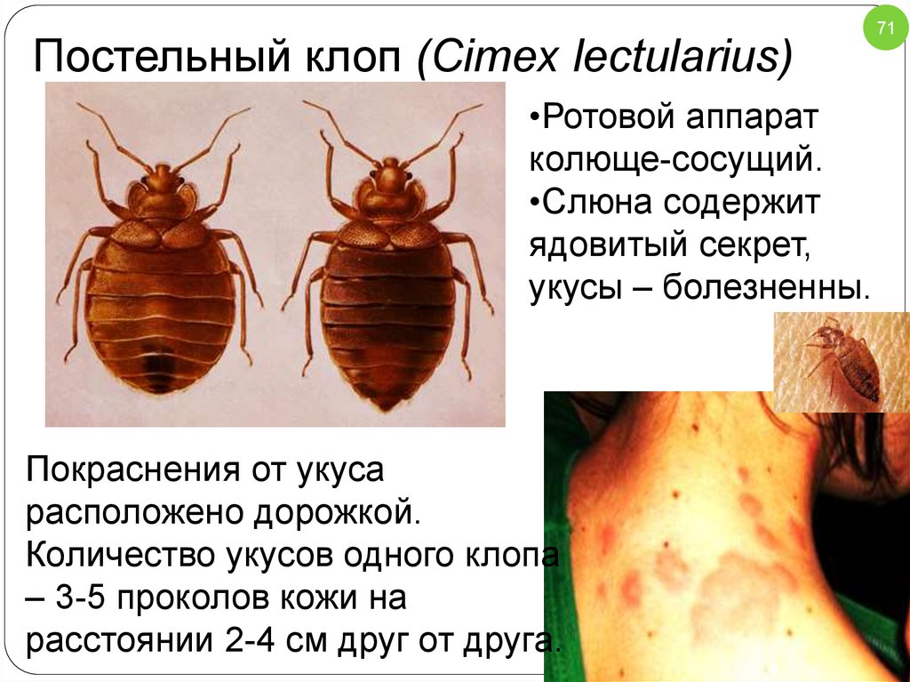 Клопы приснились во сне к чему женщине. Строение постельного клопа Cimex lectularius. Постельный клоп размер. Постельный клоп Cimex lectularius (личинки, нимфы). Cimex lectularius ротовой аппарат.