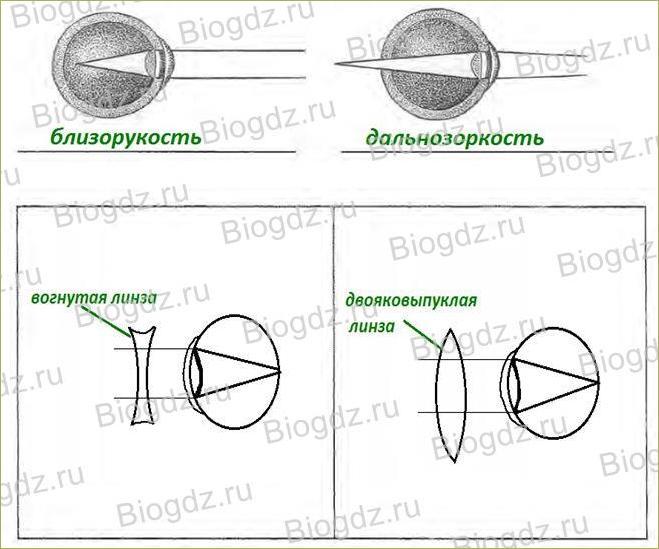 Дальнозоркость это плюс или минус. Линзы дальнозоркость вогнутые. Угол зрения изобразить графически. Рассмотрите рисунок какие дефекты зрения изображены на рисунках. Рассмотрите рисунок 33. Какие дефекты зрения изображены на рисунках.