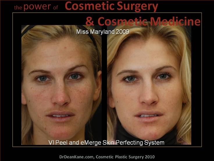 Отказ от сахара изменения. Изменение кожи лица. Лицо после отказа от сахара. Сахарное лицо до и после. Лицо до и после употребления сахара.
