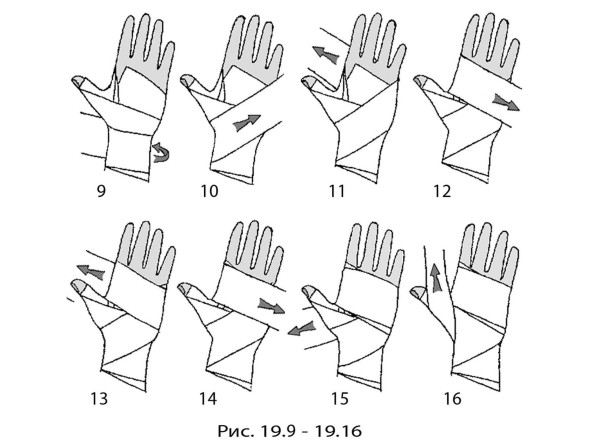 Как бинтовать руку