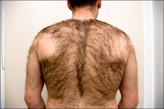 Если у мужчины не растут волосы на спине и плечах у мужчин