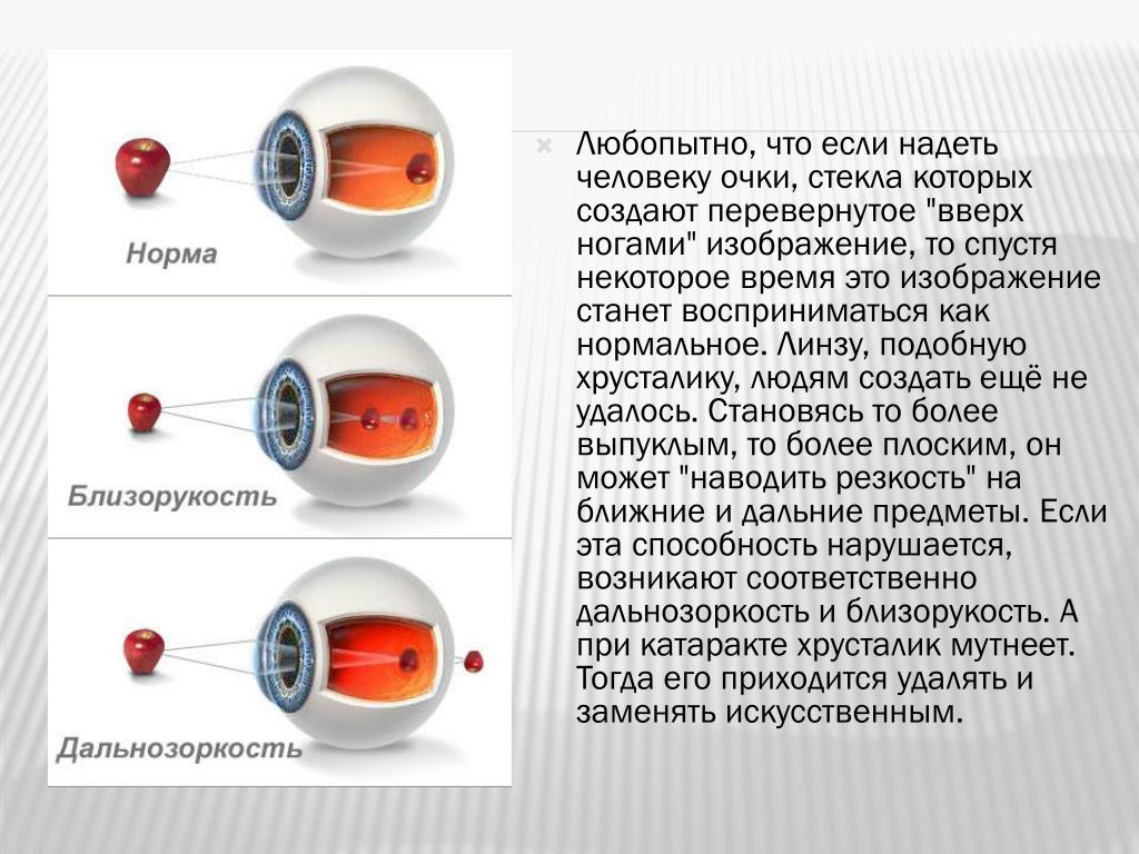 Что может служить причиной близорукости