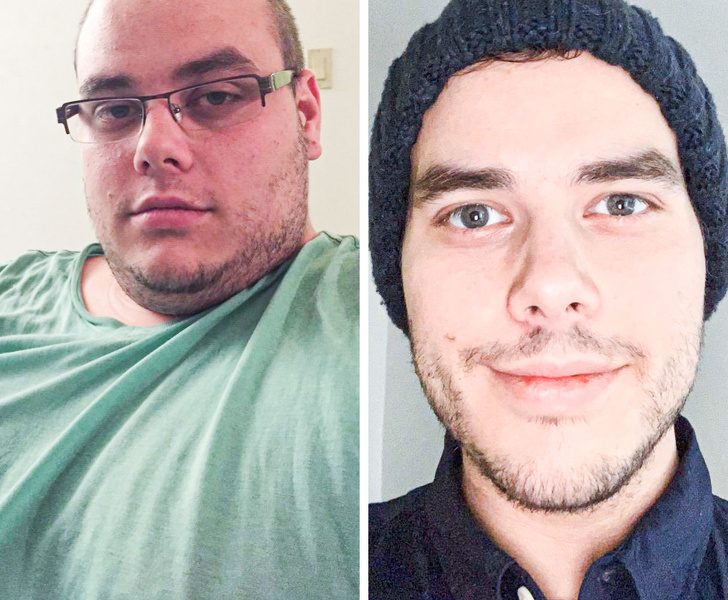 Резко изменилось лицо. Лицо после похудения. Лицо до и после похудения. Лицо до и после похудения мужчины. Люди изменившие внешность.
