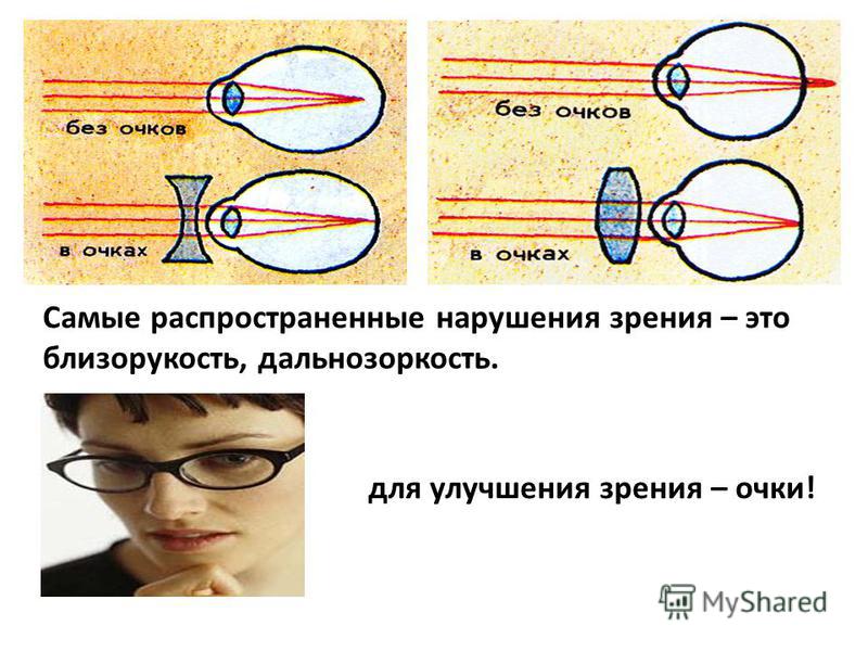 Близоруким людям необходимо использовать очки так как у них изображение