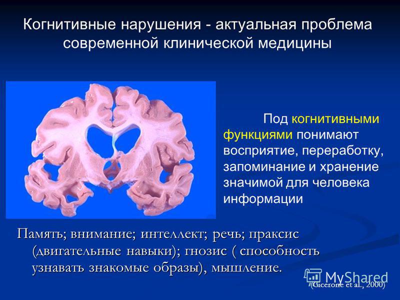 Когнитивный мозг. Когнитивные расстройства. Нарушение когнитивных функций.