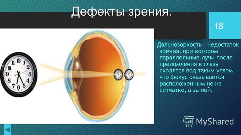 Дефекты зрения как сохранить зрение физика презентация