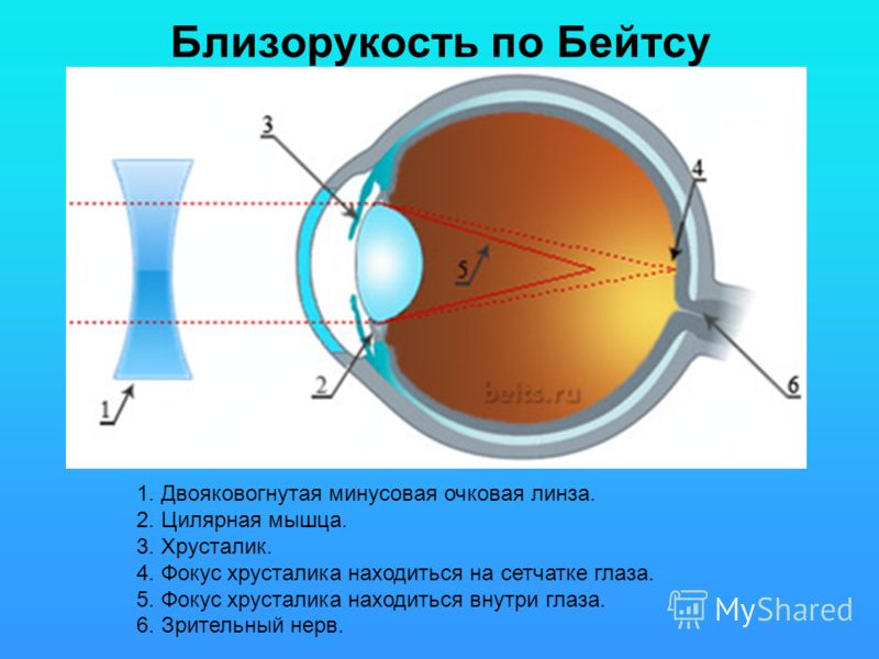 Изображение в близоруком глазу фиксируется