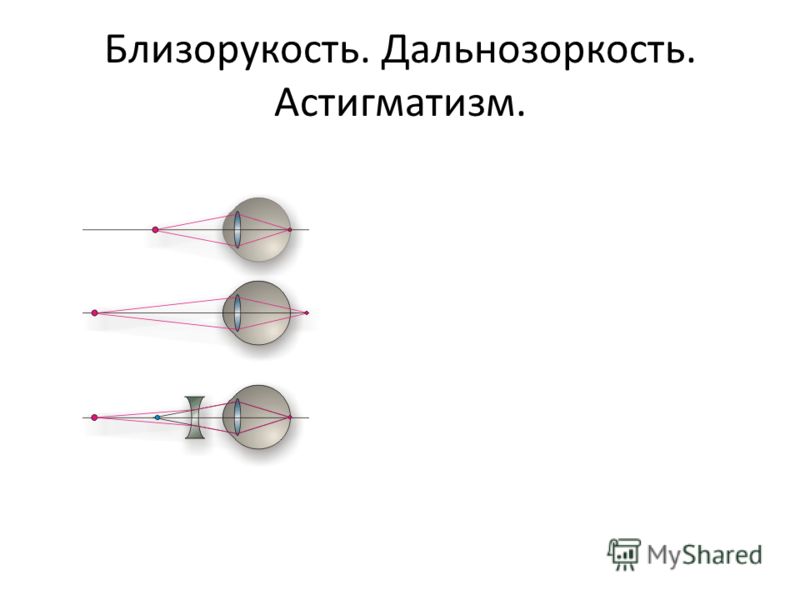 Презентация по физике дальнозоркость