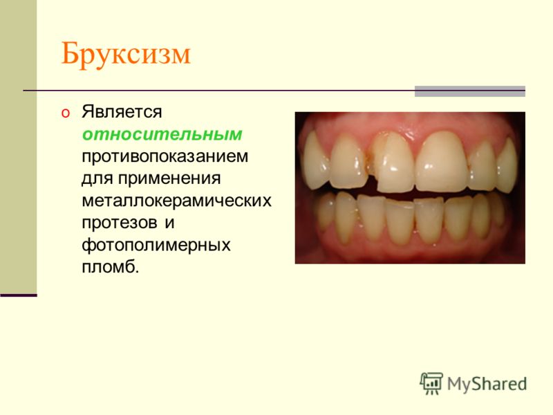 Скрипишь зубами во сне форум