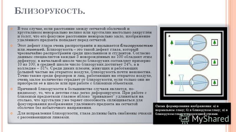 В какой части глаза происходит фокусировка изображения у людей с нормальным зрением