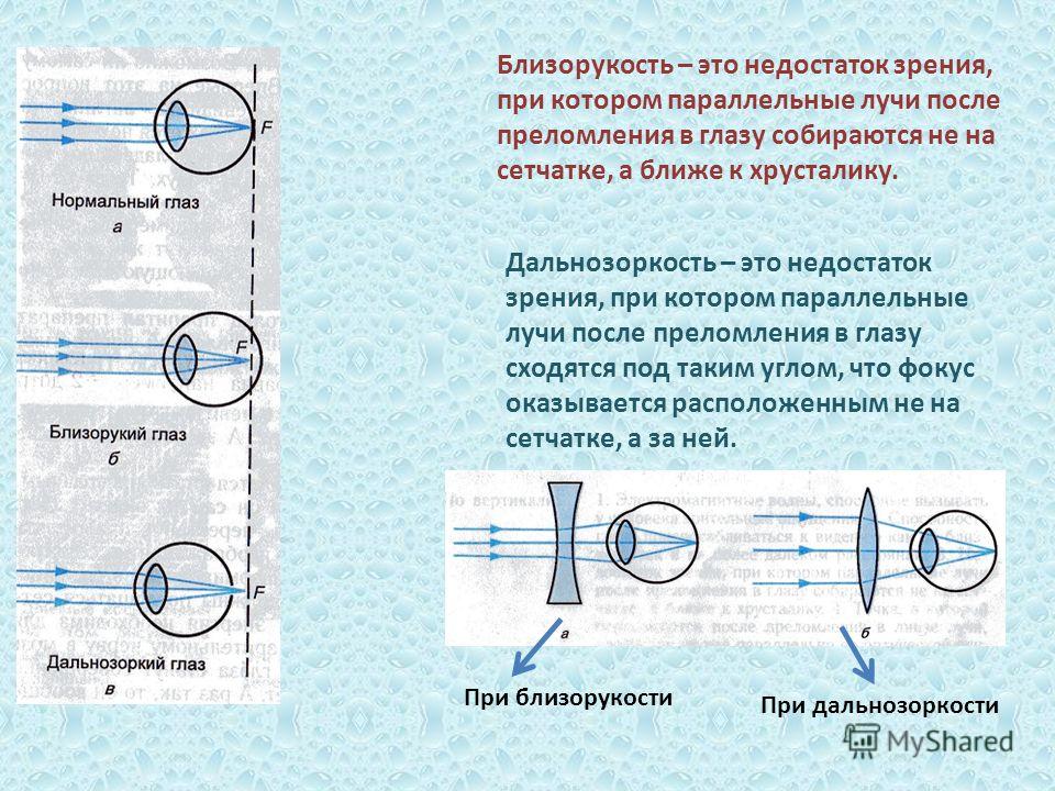 Дальнозоркость презентация по биологии