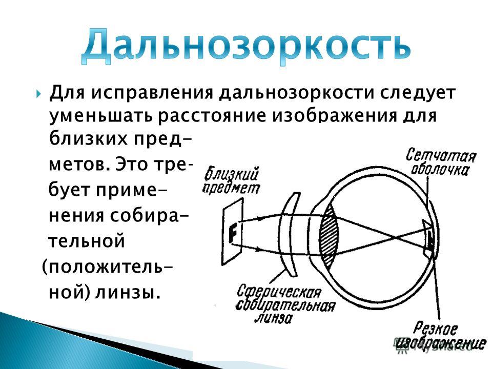 Расположение изображения предмета при дальнозоркости