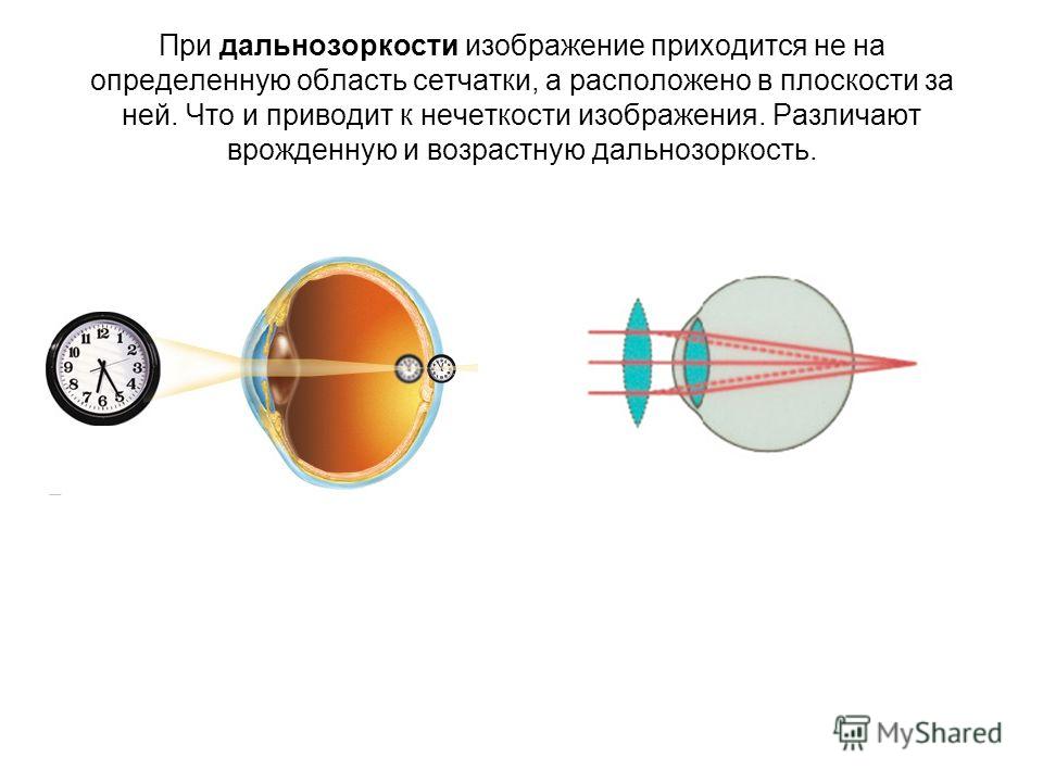 Картинки для проверки дальнозоркости