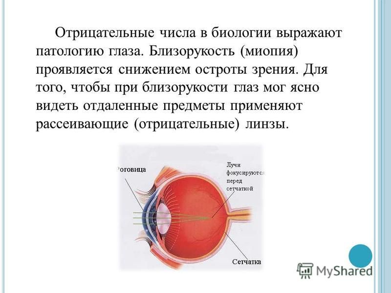 Дополните предложения изображение в близоруком