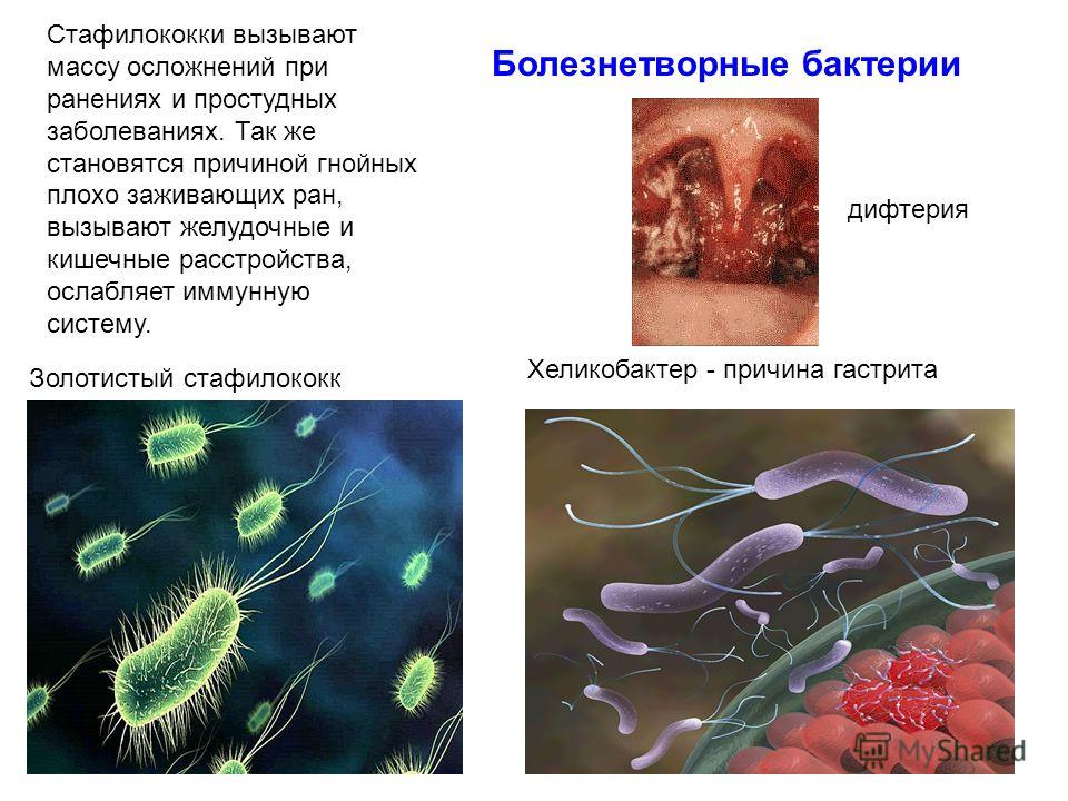 Примеры заболеваний вызываемых бактериями. Болезнетворные бактерии. Бактерии вызывающие заболевания.