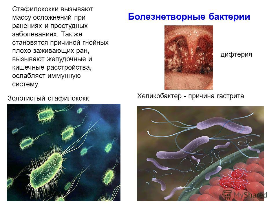 Бактерии могут вызывать болезни. Болезнетворные бактерии. Бактерии вызывающие заболевания. Болезни вызванные болезнетворными бактериями.