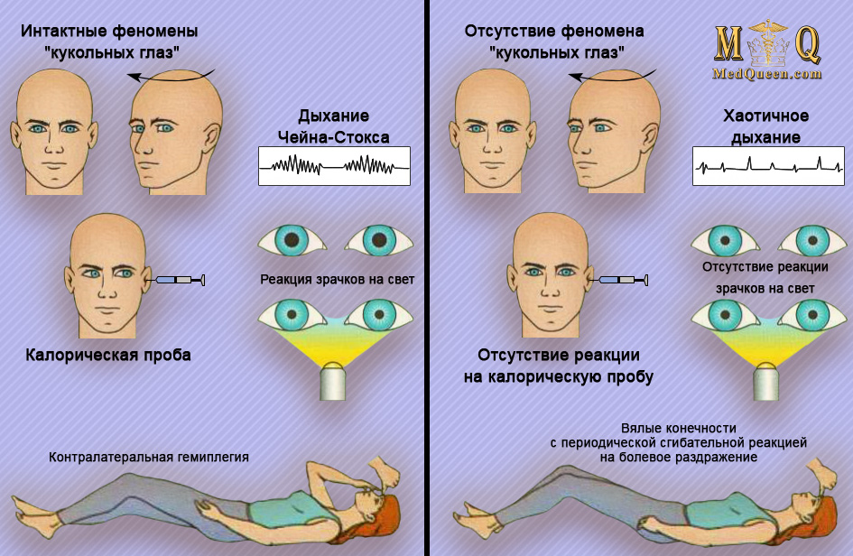 Феномен места