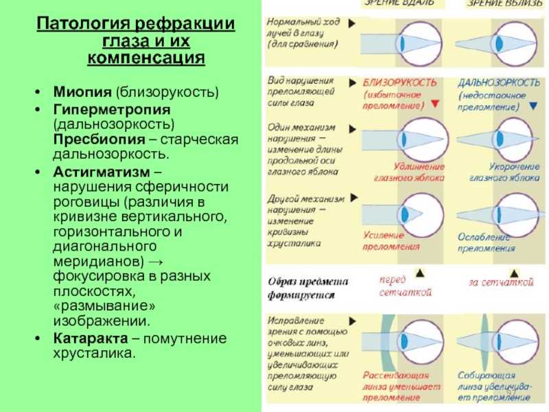 При дальнозоркости изображение возникает