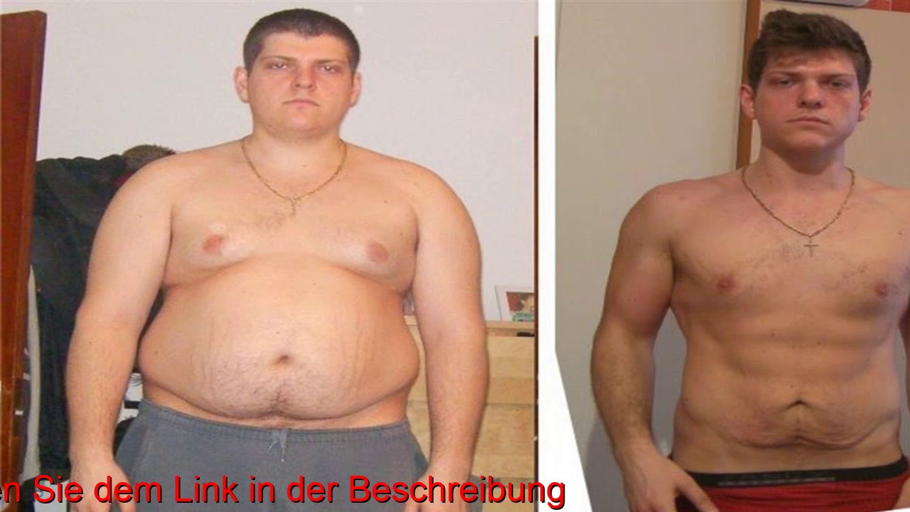 Лишний вес операция. Живот до и после похудения. Живот до и после похудения мужчины.