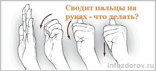 Судороги руки причина и лечение у женщин. Сводит пальцы на руках причины. Что делать если сводит пальцы на руках. Сведенные судорогой ладони.