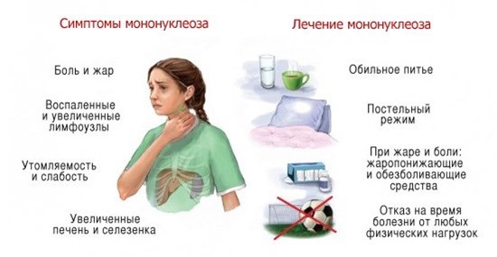 Инфекционный мононуклеоз симптомы и лечение