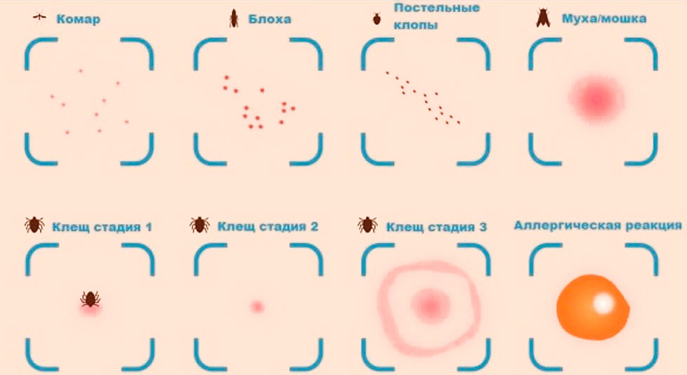 Отличия укуса клеща от укусов других насекомых (сравнение следов от укусов)