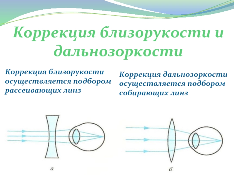 Близорукость схема глаза